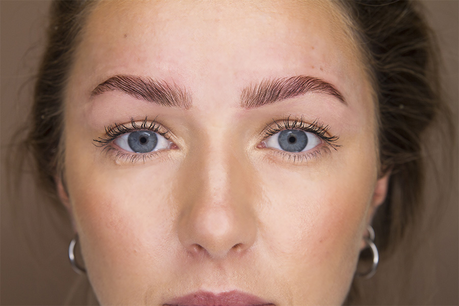 brow-1